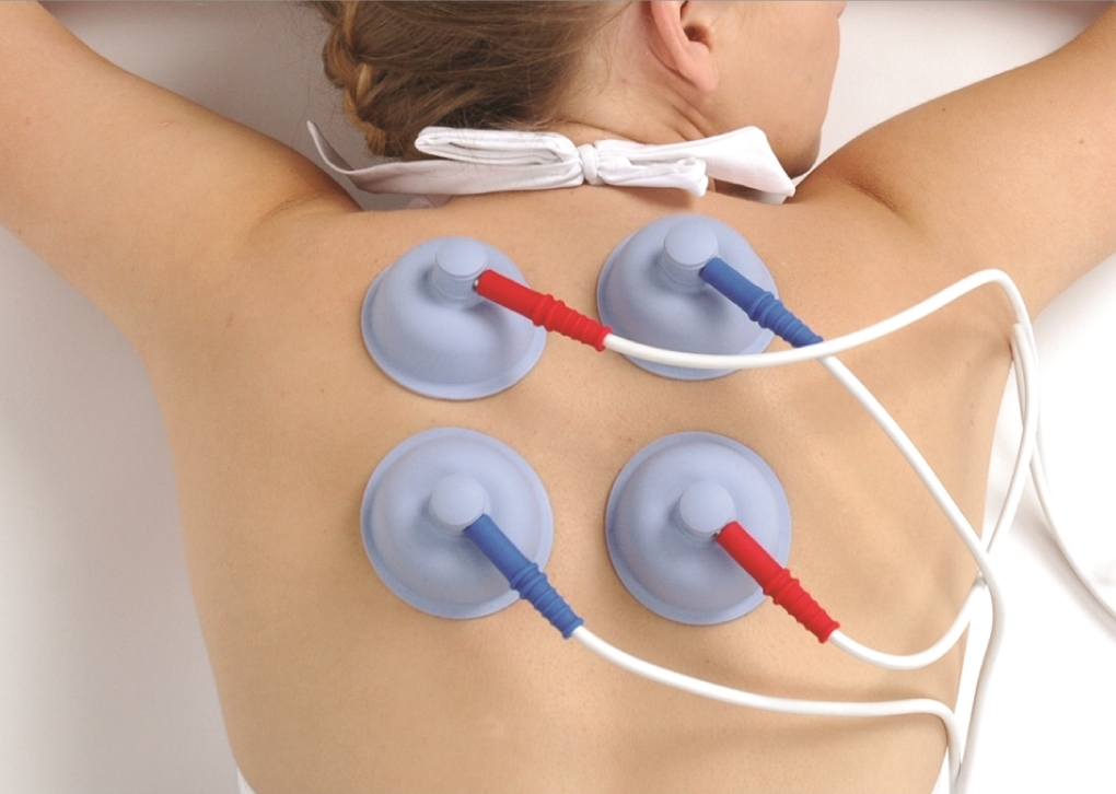 What is Interferential Current Therapy in Physiotherapy?