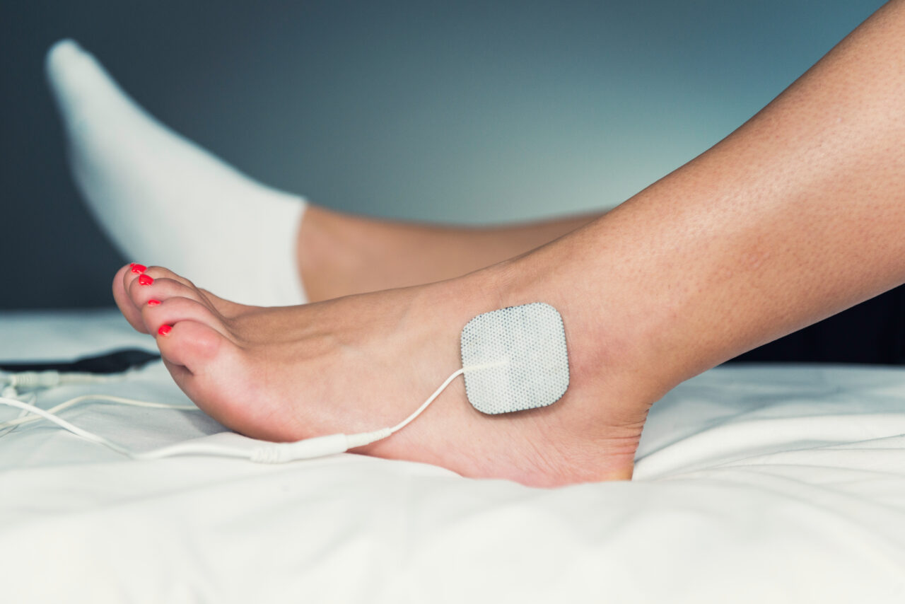 TENS Units For Neuropathy: Everything You Need To Know