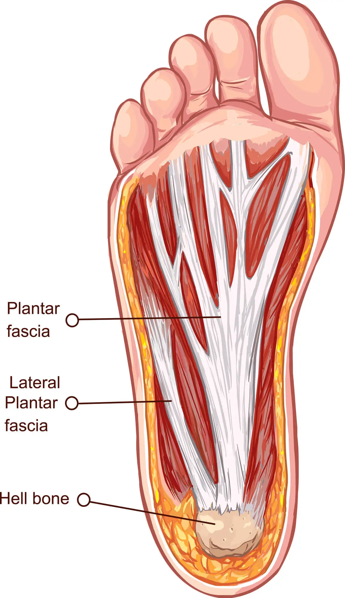 Plantar fasciitis is heel pain | PDF