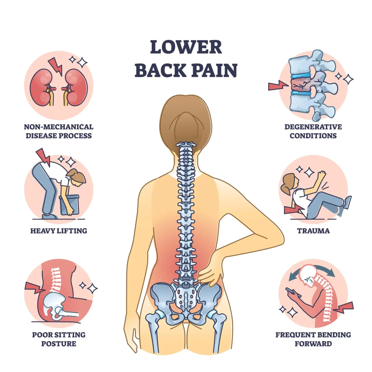Back Muscle Pain Relief and Severe Lower Back Strain