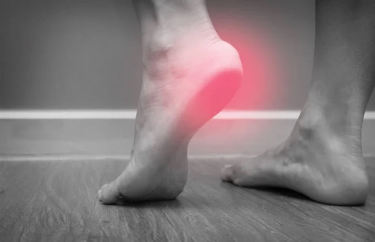 Plantar Fasciitis 101: Signs, Causes, Treatment & Prevention - Homage  Malaysia