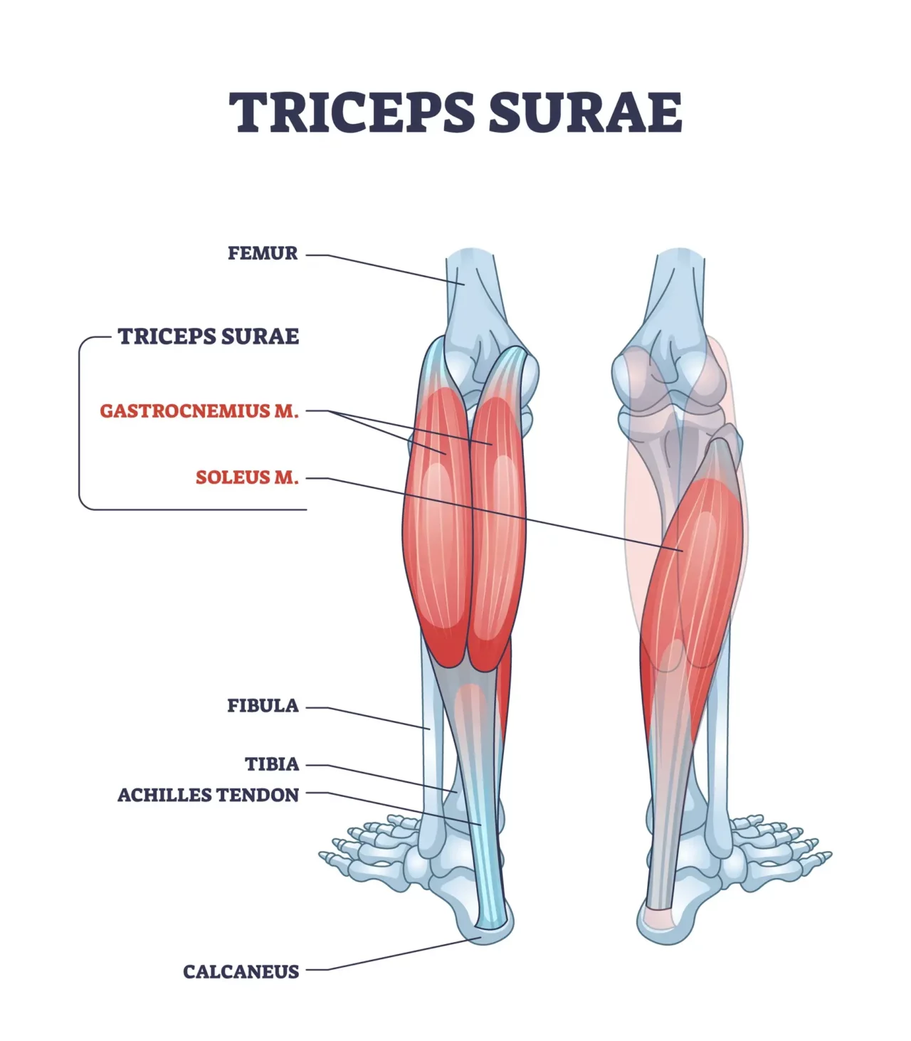 Tight Calf Muscles in Runners: Causes and Treatment